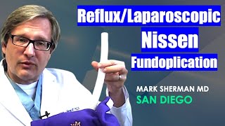 Reflux  Laparoscopic Nissen Fundoplication  San Diego [upl. by Ggerg]