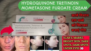 ElosoneHT cream review  Hydroquinone tretinoin Mometasone Furoate Cream  use in hindi [upl. by Xerxes]