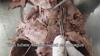 Thyroid gland  Dissection [upl. by Ardnasela]