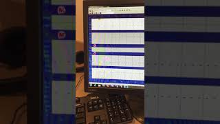 Xrays and Perio Chart for Dentrix [upl. by Bruyn156]