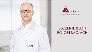 Leczenie blizn po operacjach chirurgii plastycznej [upl. by Neala]