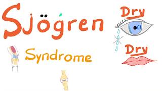 Sjögren Syndrome  Dry eyes Dry mouth Arthritis  Rheumatology Series [upl. by Nahtnaoj]