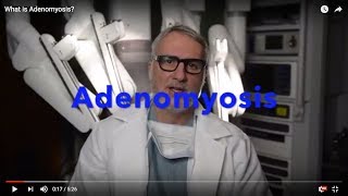 What is Adenomyosis [upl. by Nottap]