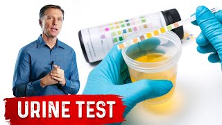 Urine Test Simplified [upl. by Kirred326]