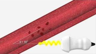 Ultrasound Physics  Explaining Doppler [upl. by Airretal]