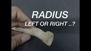 RADIUS  SIDE DETERMINATION [upl. by Esekram]