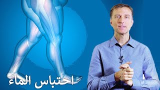 التخلص من احتباس الماء الزائد بالجسم بدون أدوية  اسبابه وعلاجه الفعال والسريع [upl. by Andryc660]