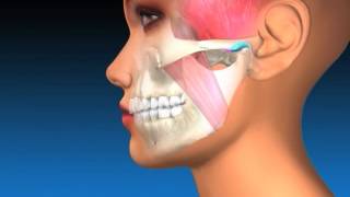 TMJ Explanation amp Therapy [upl. by Joni291]