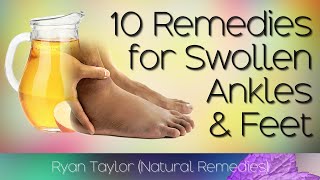 10 Home Remedies for Swollen Feet and Ankles [upl. by Ecilef]