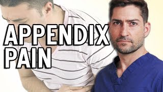 How do I know if I have appendicitis [upl. by Mackay710]