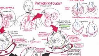 Pleura anatomy [upl. by Duer]