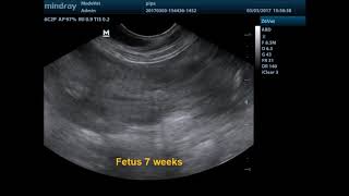 Ultrasound canine fetus development [upl. by Llevol70]