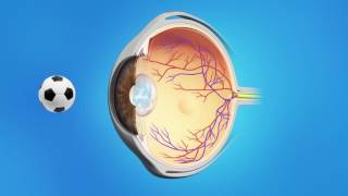 More Unusual Cosmetic Procedures [upl. by Camarata]