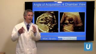 What is acyanotic heart disease  Circulatory System and Disease  NCLEXRN  Khan Academy [upl. by Ednargel16]