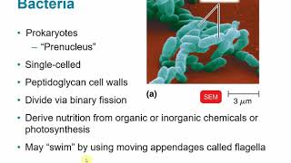 Gram Negative Bacteria Bordetella Pertussis [upl. by Uuge]