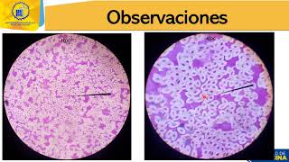 Práctica de laboratorio Observación de células en vivo [upl. by Hairahcez589]