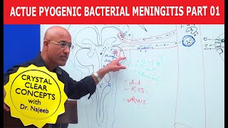 Acute Pyogenic Bacterial Meningitis Part 1 🩺 [upl. by Vadim]