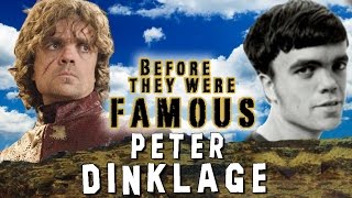 PETER DINKLAGE  Before They Were Famous [upl. by Aneelas]