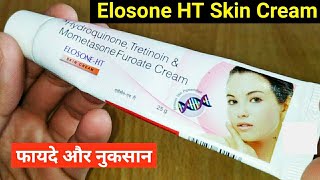 Elosone HT Skin Cream Ke Fayde Or Nuksan  Hydroquinone Tretinoin amp Mometasone Furoate Cream [upl. by Tillio]