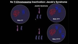 Jacobs Syndrome  A YChromosome Aneuploidy [upl. by Llecrup]