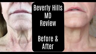 Beverly Hills MD Dermal Repair Complex—Lift and Firm Sculpting Cream—Before and After—AntiAging [upl. by Becka]