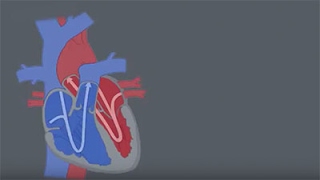 Congenital Heart Defects CHDs [upl. by Enaywd]