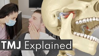 TMJ Explained  Jaw Pain Causes amp Symptoms [upl. by Teddman986]