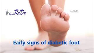 Early Signs of Diabetic Foot [upl. by Kcirdde976]