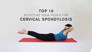 Top 10 Effective Yoga Poses for Cervical Spondylosis [upl. by Pierro]