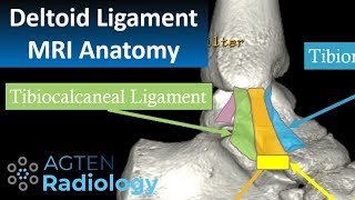 MRI Anatomy of Ankle Ligaments Deltoid Ligament [upl. by Alded]