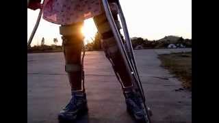 Leg braces in evening sunlight [upl. by Ciel]