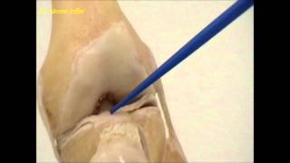 Anatomy of the knee joint [upl. by Bertsche]