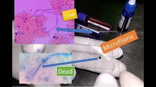 Microfilaria live and dead under Microscope [upl. by Armando]