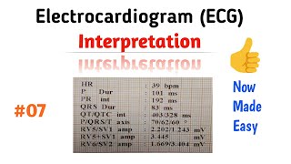 How to Read an ECG interpretation  07 QTQTc Interval [upl. by Ferguson]