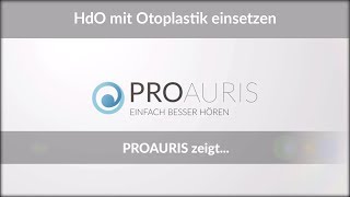 HinterdemOhrHörgerät mit Otoplastik einsetzen – PROAURIS [upl. by Vinson]