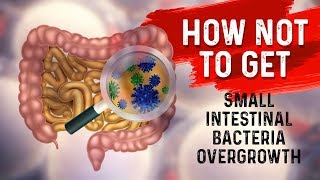 How to STOP Small Intestine Bacterial OvergrowthSIBO – Dr Berg [upl. by Darelle]