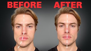 How to Fix Asymmetrical Jaw amp Face FOREVER [upl. by Annaohj896]