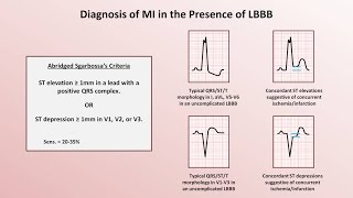 Intro to EKG Interpretation  Myocardial Infarctions Part 2 of 2 [upl. by Ylera]