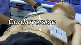 Cardioversion  Defibrillation Technique [upl. by Odeen]