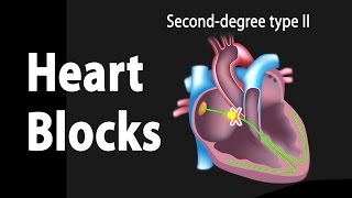 Heart Blocks Anatomy and ECG Reading Animation [upl. by Oilut839]