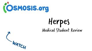 Herpes  Clinical Presentation [upl. by Swagerty]