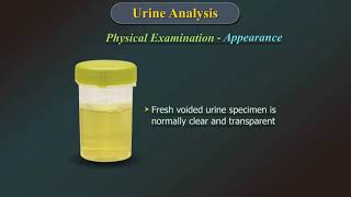 Urine Analysis [upl. by Nolram]