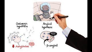 Dementia Treatment Options [upl. by Fi]