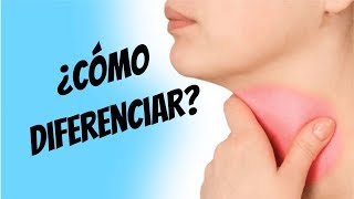 ¿Cómo diferenciar una faringitis viral y bacteriana Estreptococo beta hemolítico [upl. by Duncan]