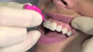 How to use an interdental brush  AJ Hedger [upl. by Modesty984]