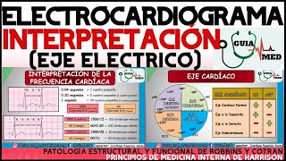 ELECTROCARDIOGRAMA INTERPRETACIÓN  GuiaMed [upl. by Anovad659]