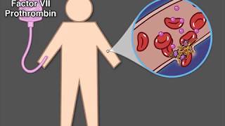 Treating Hemophilia A [upl. by Ahsinawt]