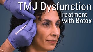 TMJ Dysfunction Treatment with Botox®  Sneak Preview [upl. by Fritzie]