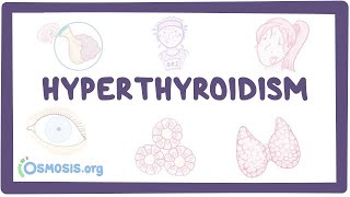 Hyperthyroidism  an Osmosis Preview [upl. by Emee]