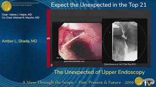 The Unexpected of Upper Endoscopy [upl. by Waylan]